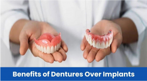 Dentures: Cost-effective option Dentures: Cost-effective option